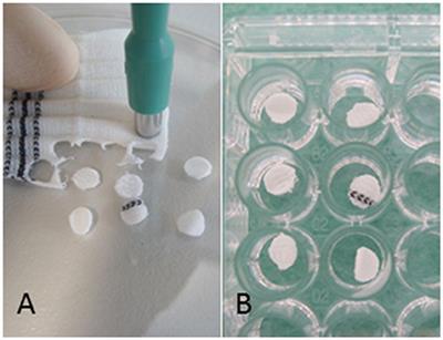 Rapid in Vitro Quantification of S. aureus Biofilms on Vascular Graft Surfaces